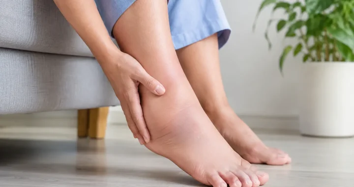 Por qué se hinchan los pies y cuándo preocuparse